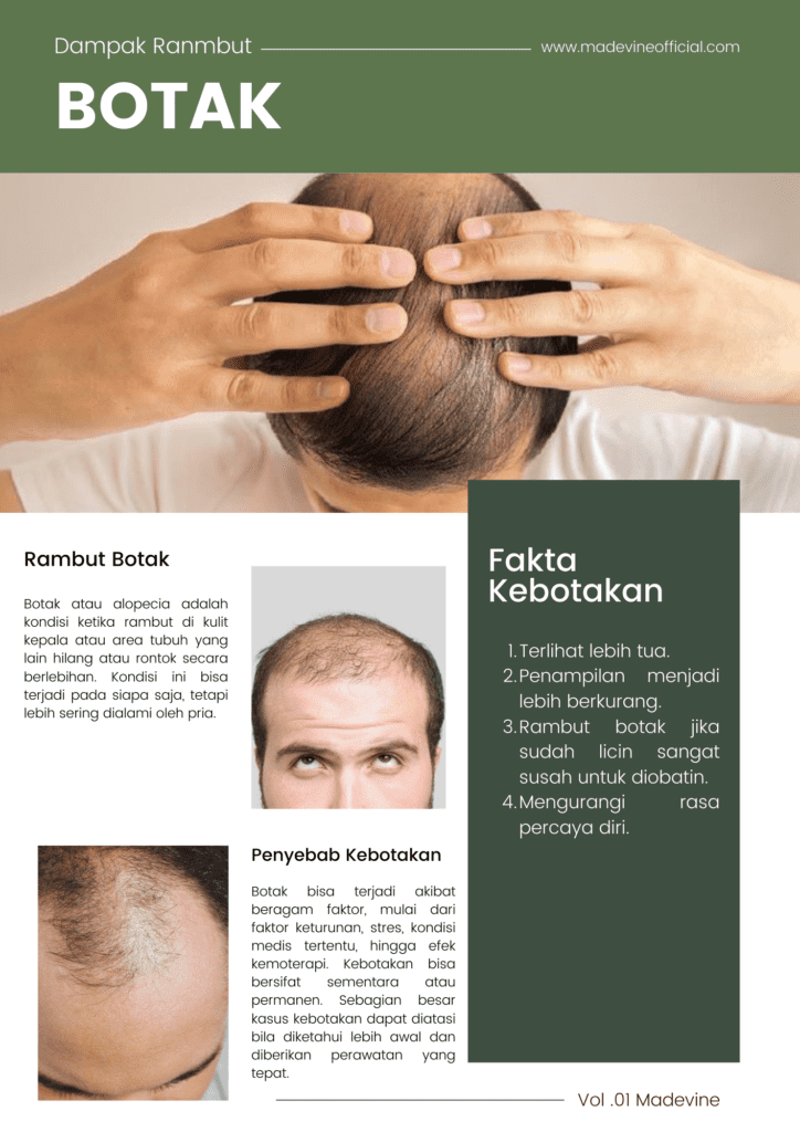 Gambar Pamflet Kebotakan