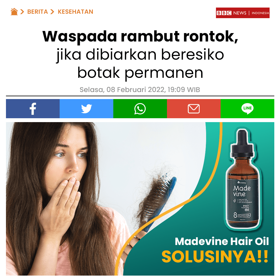 Jual vitamin rambut untuk rambut rontok di Aceh Besar Bisa COD